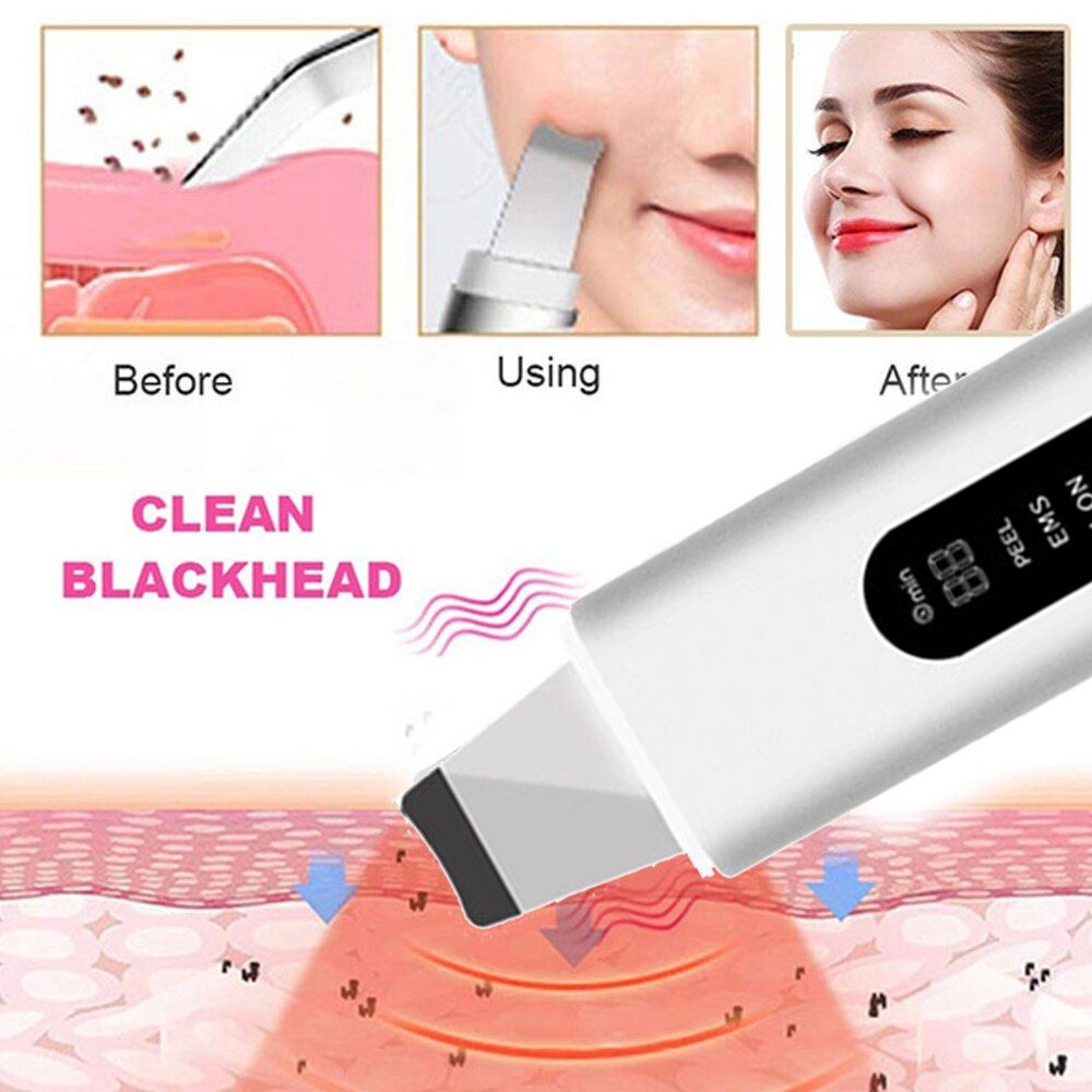 GlowEase™ Skin Scrubber - Your Path to Flawless Skin! - luvinly