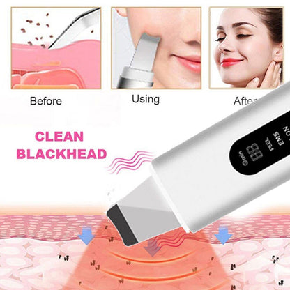 GlowEase™ Skin Scrubber - Your Path to Flawless Skin! - luvinly