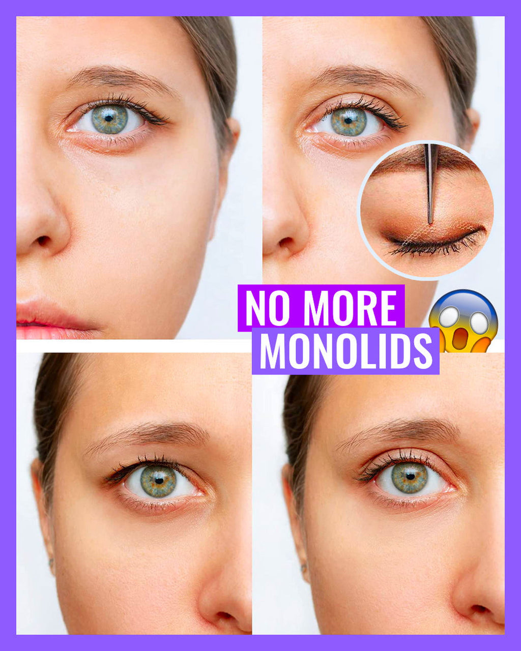 StealthLid™ - Invisible Double Eyelid Sticker - luvinly